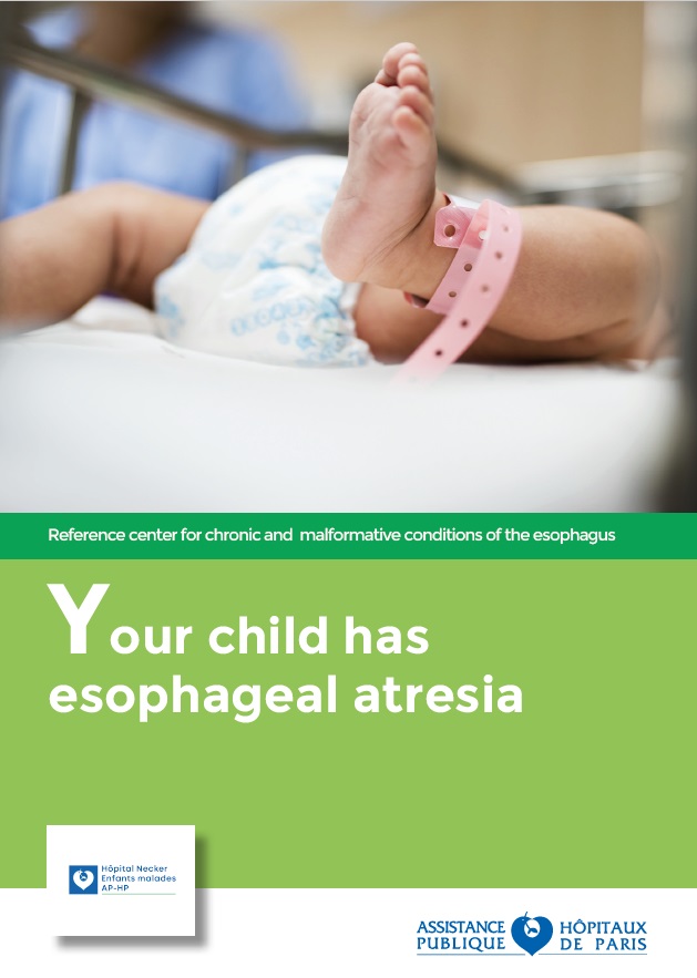 Esophageal atresia